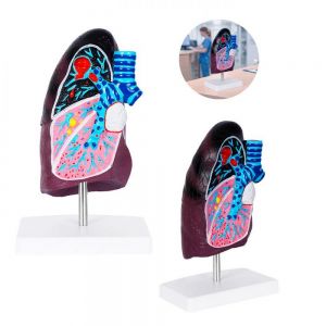 MODELO NEUMO personalizada